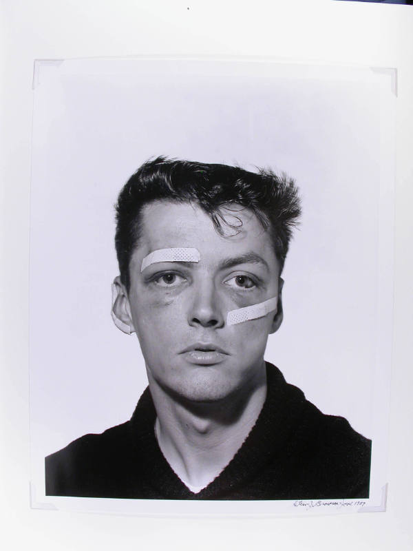 Robert D. Cash with Bruised Face